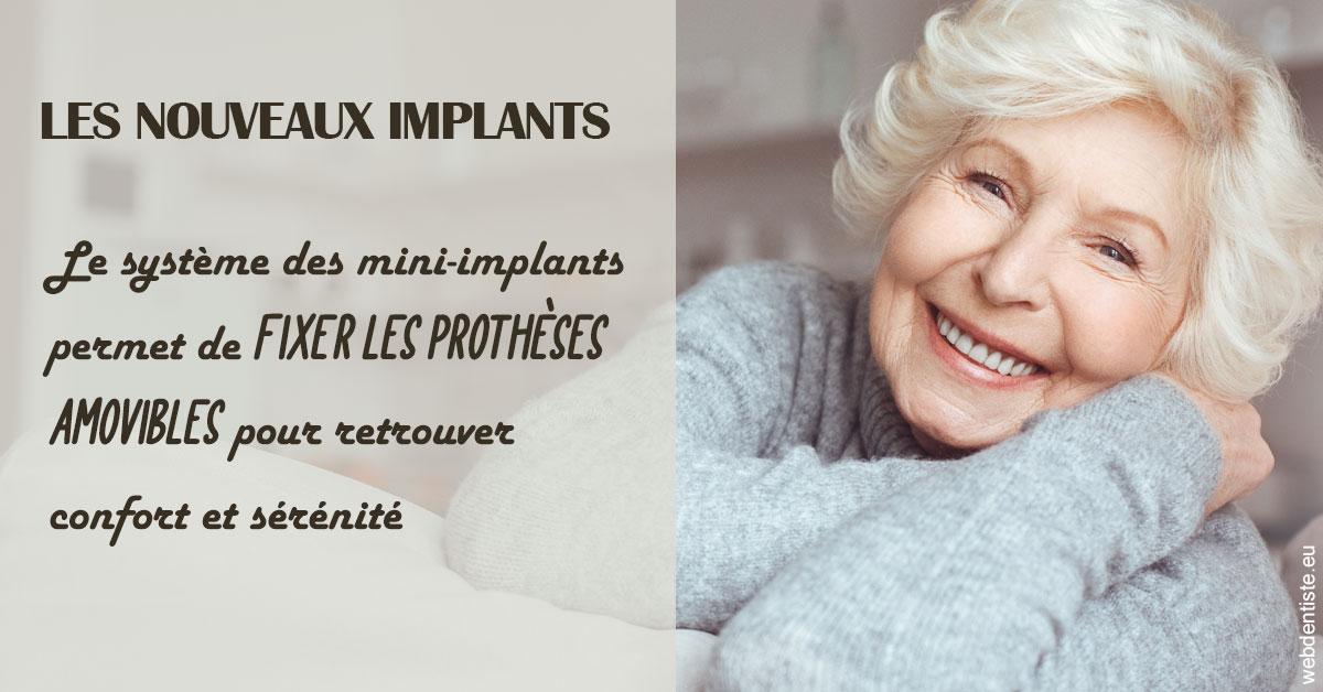 https://www.drchristianehalimi.fr/Les nouveaux implants 1