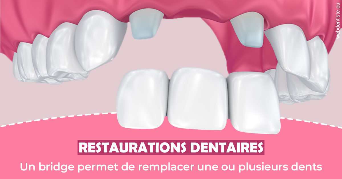 https://www.drchristianehalimi.fr/Bridge remplacer dents 2