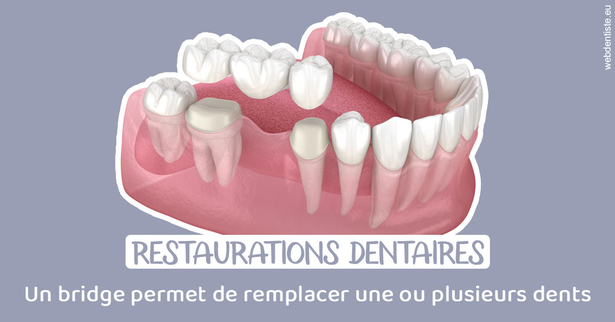 https://www.drchristianehalimi.fr/Bridge remplacer dents 1