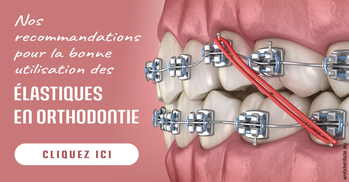 https://www.drchristianehalimi.fr/Elastiques orthodontie 2